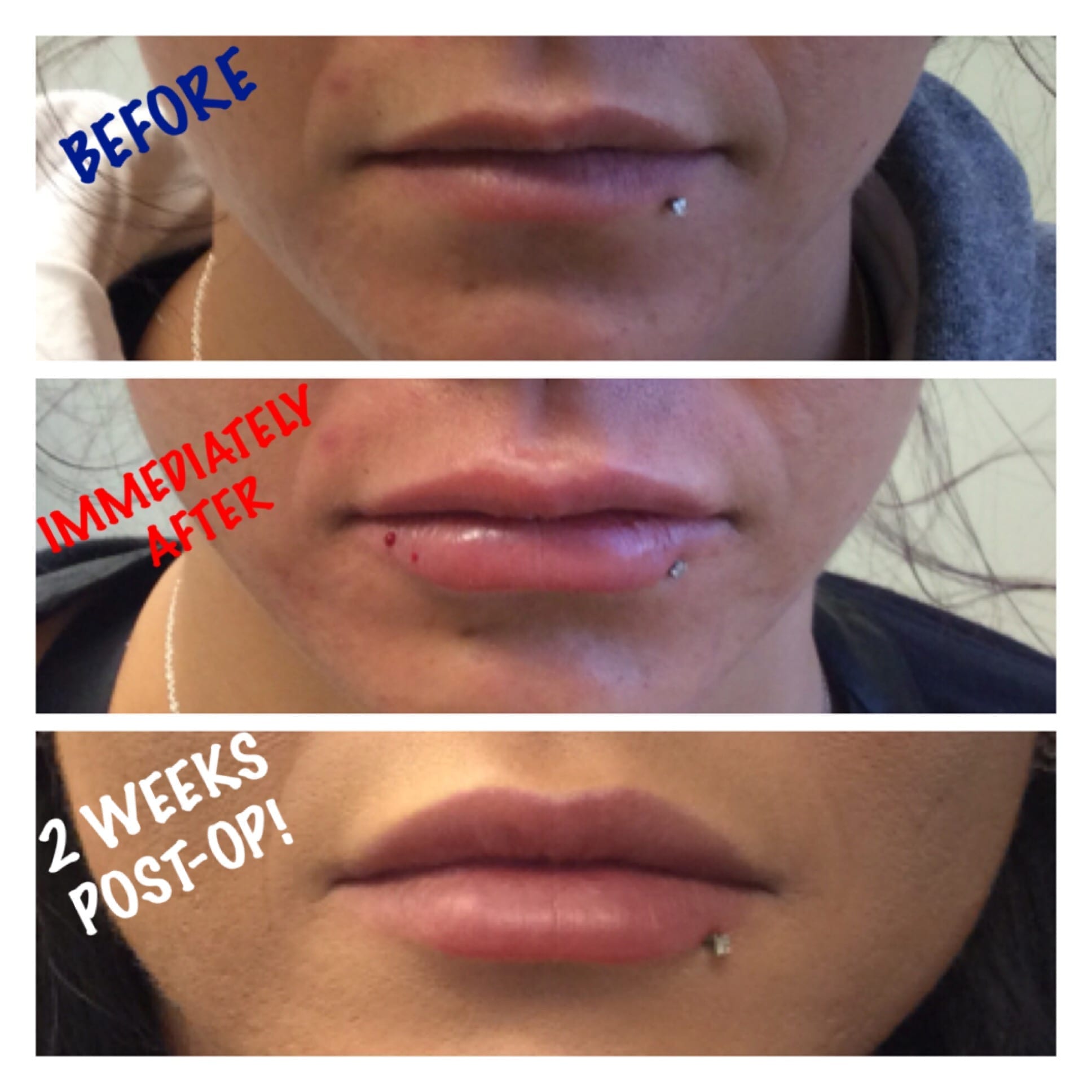 Before and After Image