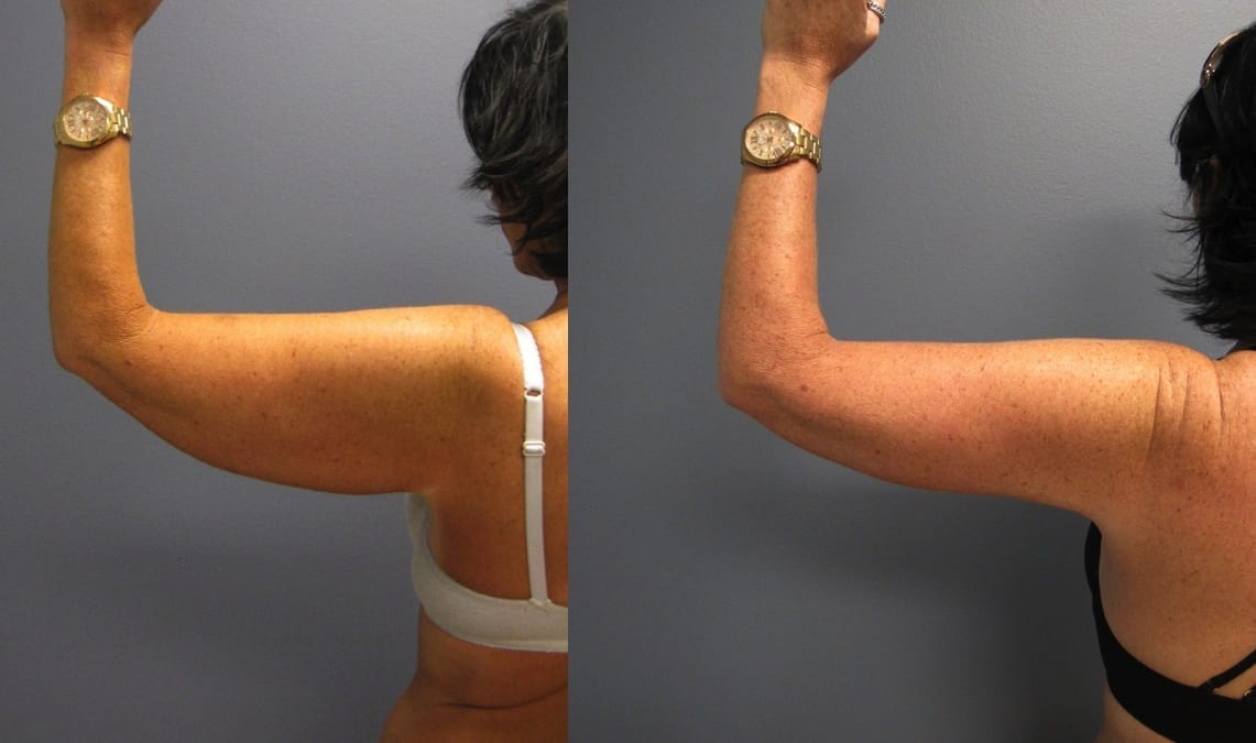 Before and After Image