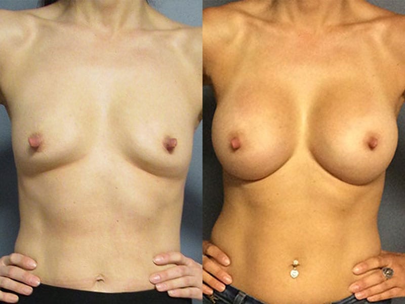 Before and After Image