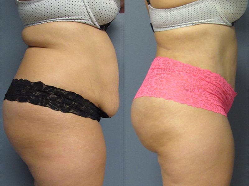 Before and After Image