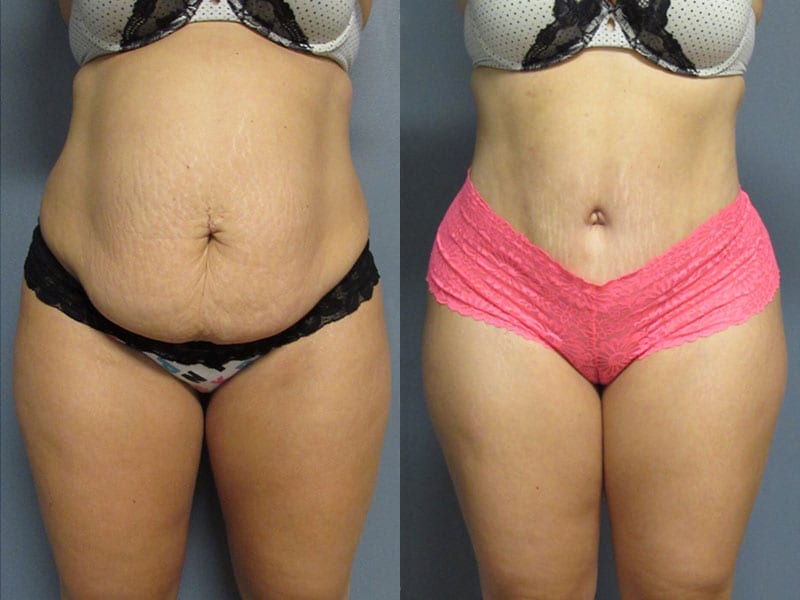 Before and After Image