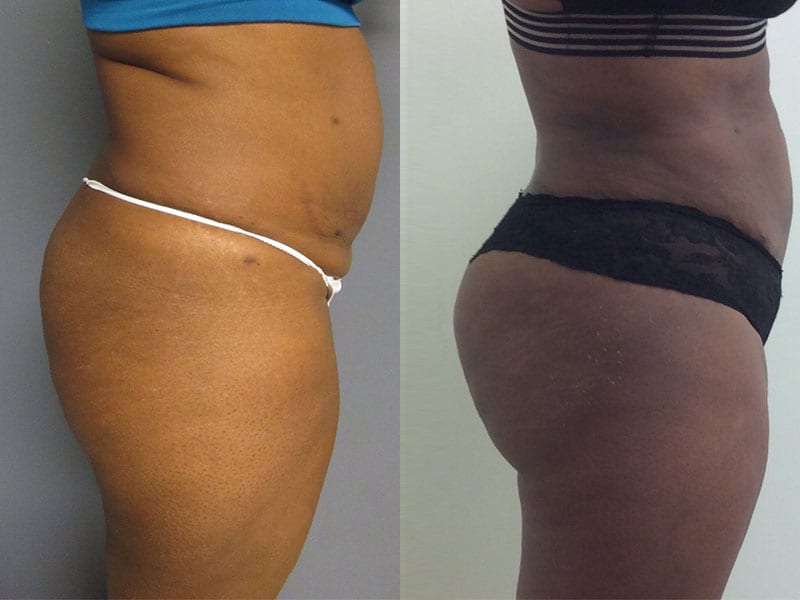 Before and After Image