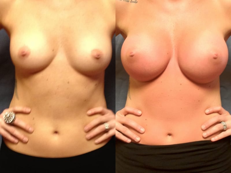 Before and After Image
