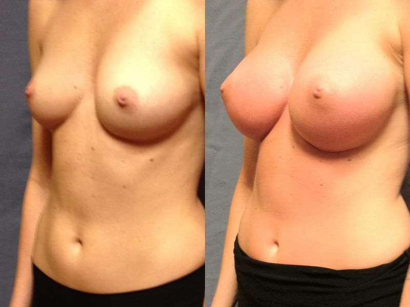 Before and After Image