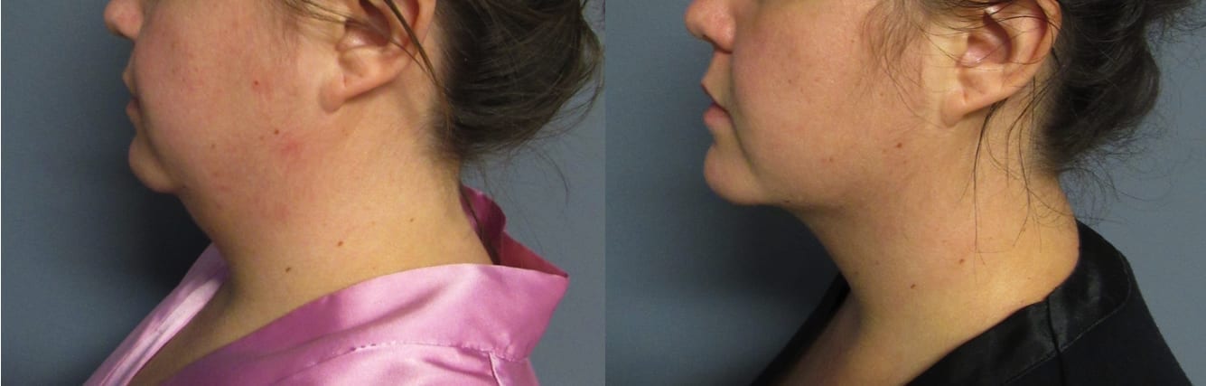 Before and After Image