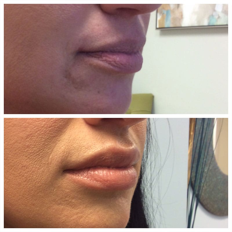 Before and After Image