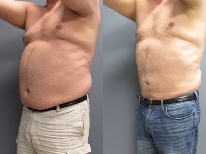 Before and After Image