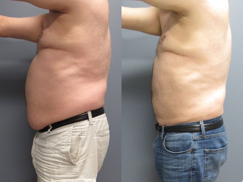 Before and After Image