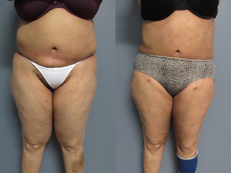 Before and After Image