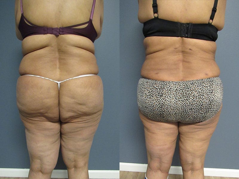 Before and After Image