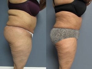 Before and After Image