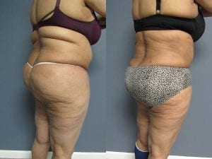 Before and After Image
