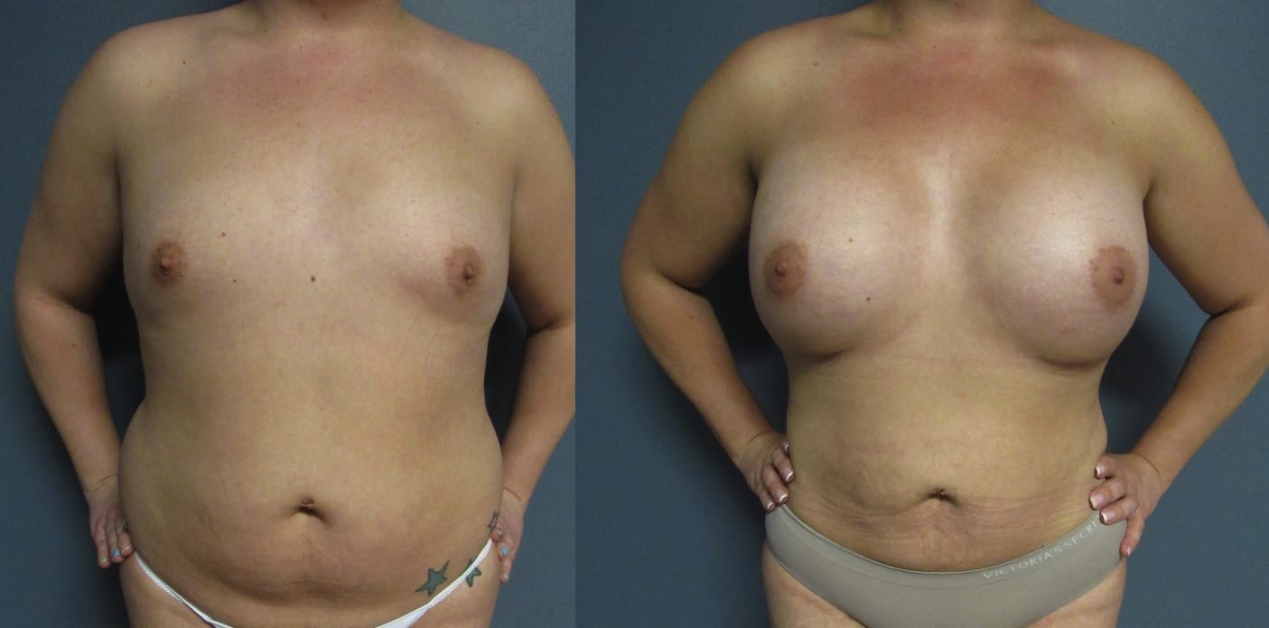 Before and After Image