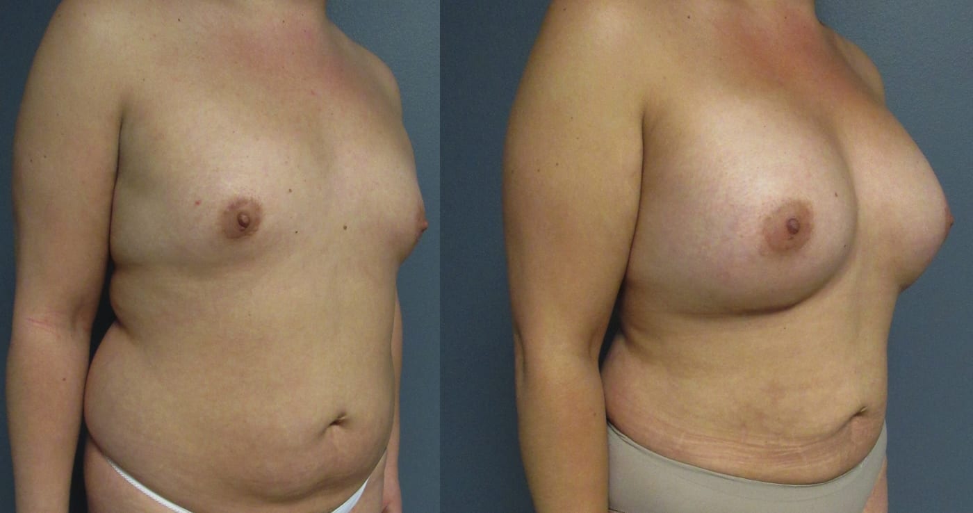 Before and After Image