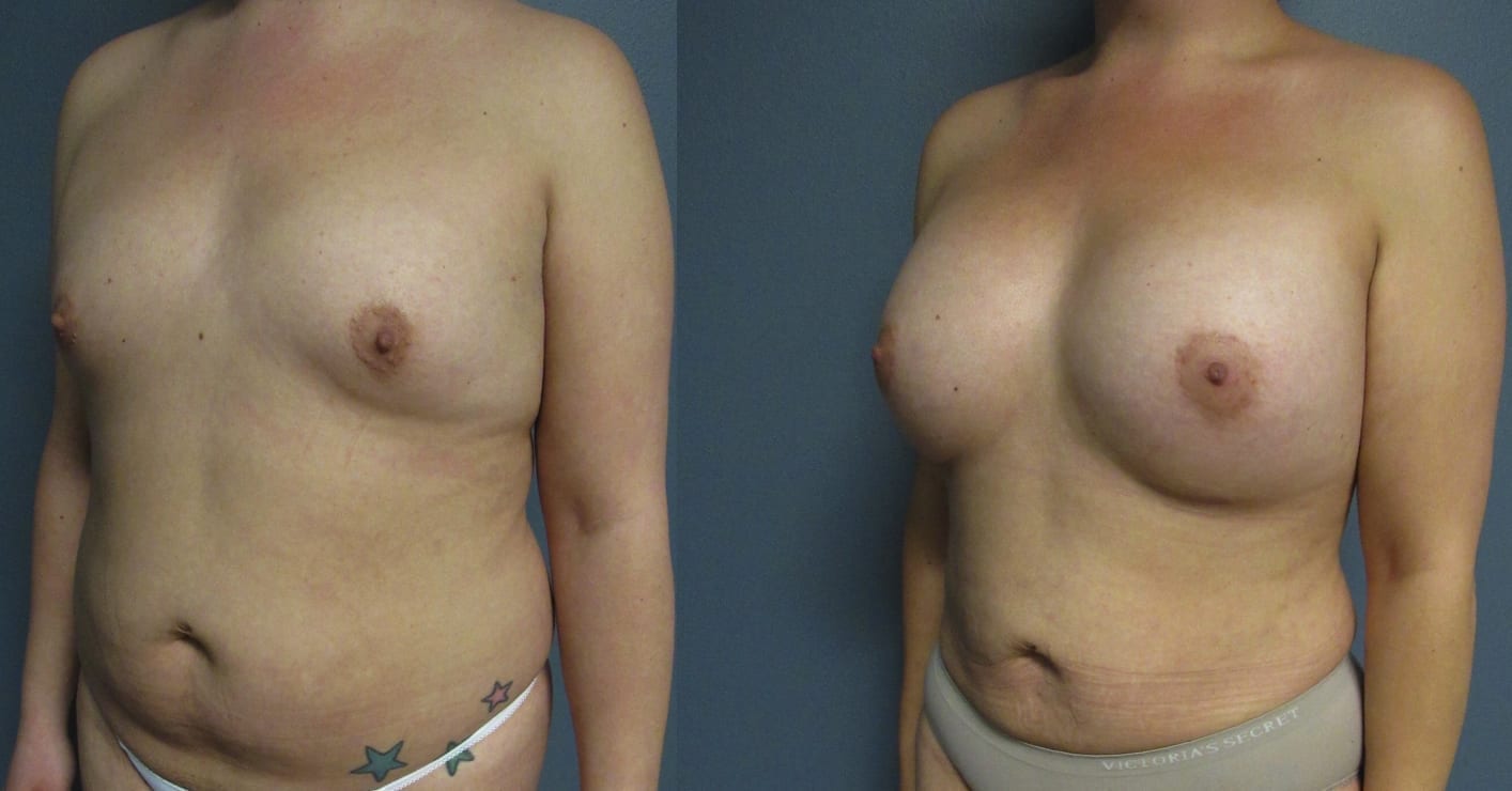 Before and After Image