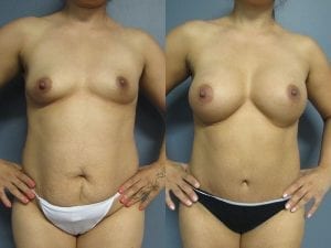 Before and After Image