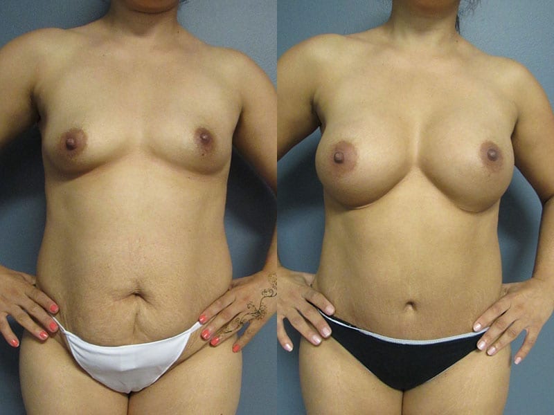 Before and After Image