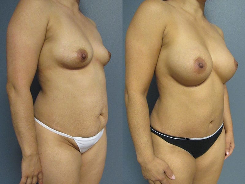 Before and After Image