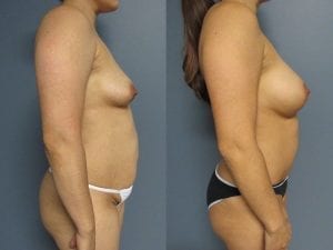 Before and After Image