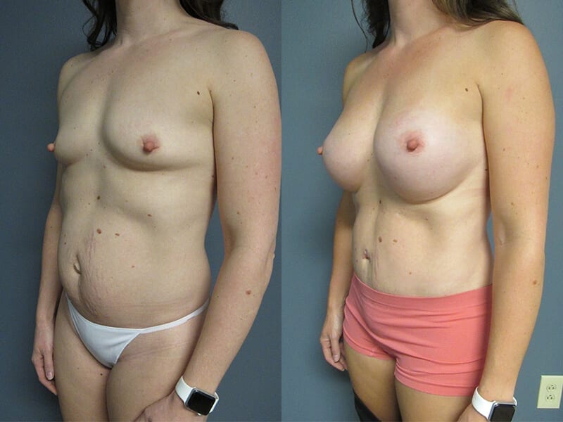 Before and After Image