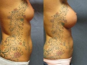Before and After Image