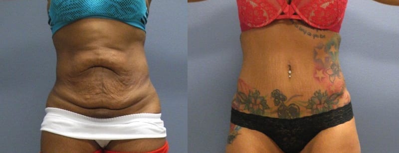 Before and After Image